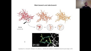 Talk: The Dendrograms of Neuron Morphologies exhibit Asymmetrical Motifs