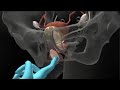 Kegel exercises for female urinary incontinence  anatomical 3d visualization