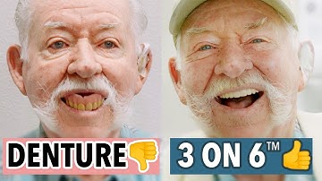 He Ditched His Dentures for the New 3 on 6™ System