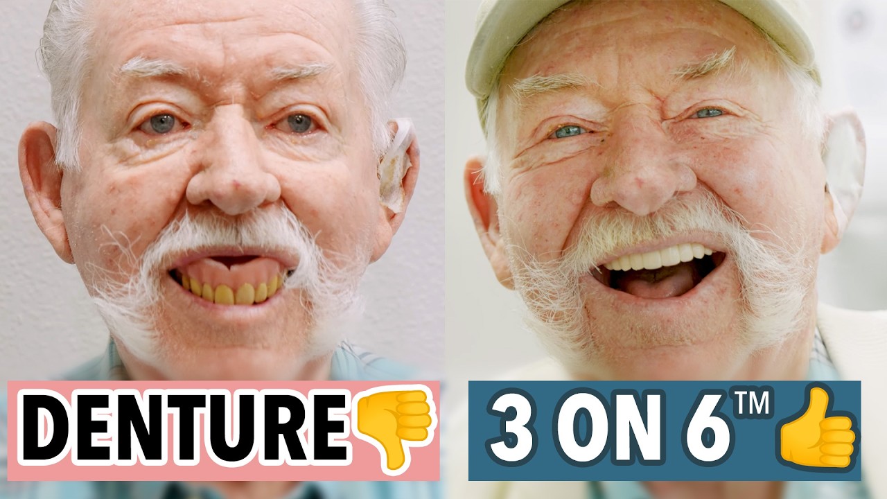 Он отказался от своих зубных протезов ради новой системы 3 на 6™