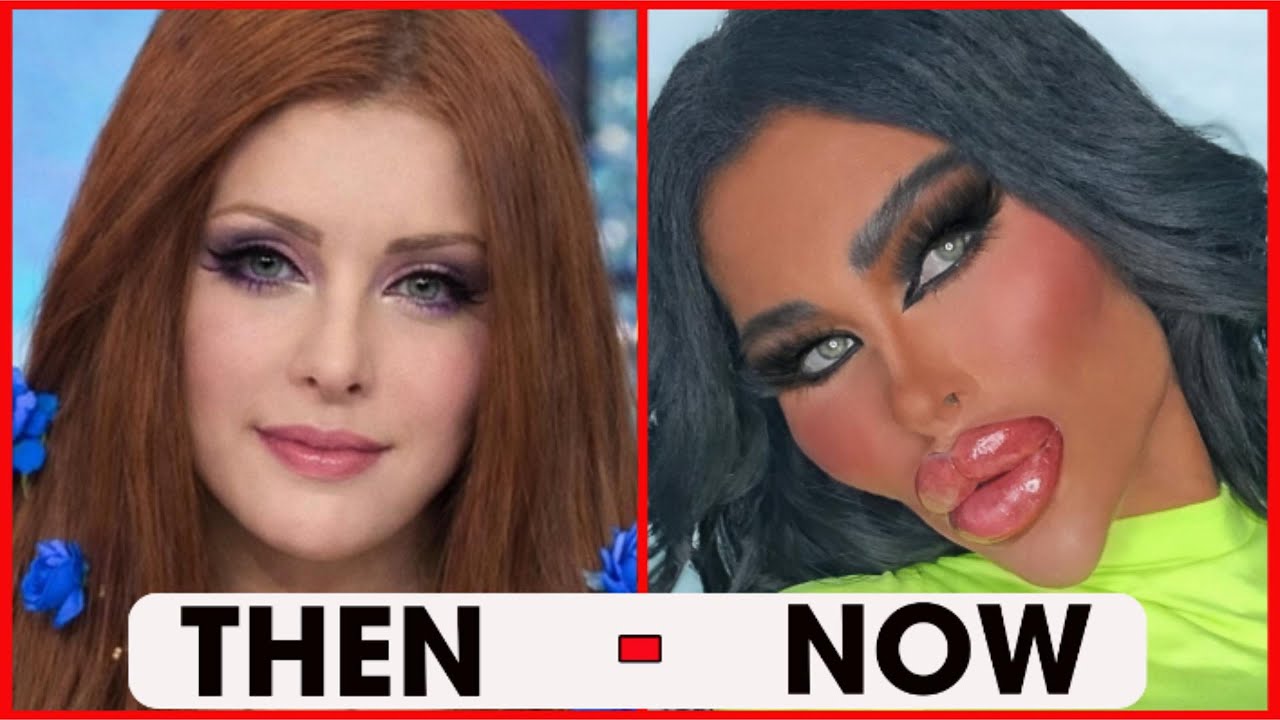 The Most Shocking Plastic Surgery Transformations Then And Now 2026