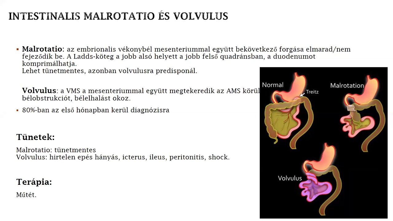 fórum a papilloma kenőcsök eltávolítására