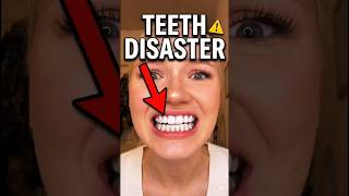 TEETH DISASTER! 😱
