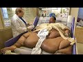 Can You Guess His Weight? Most Overweight People in the World