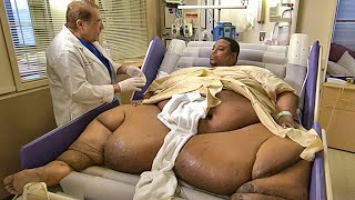 Can You Guess His Weight? Most Overweight People in the World by Ultimate Fact 293,465 views 1 month ago 23 minutes