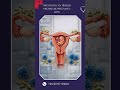 Recurrent Pregnancy Loss in Second Trimester – Causes &amp; Treatment