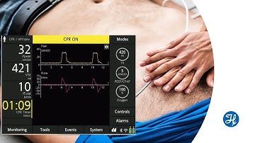Feature spotlight | CPR ventilation for HAMILTON-C1/T1/MR1