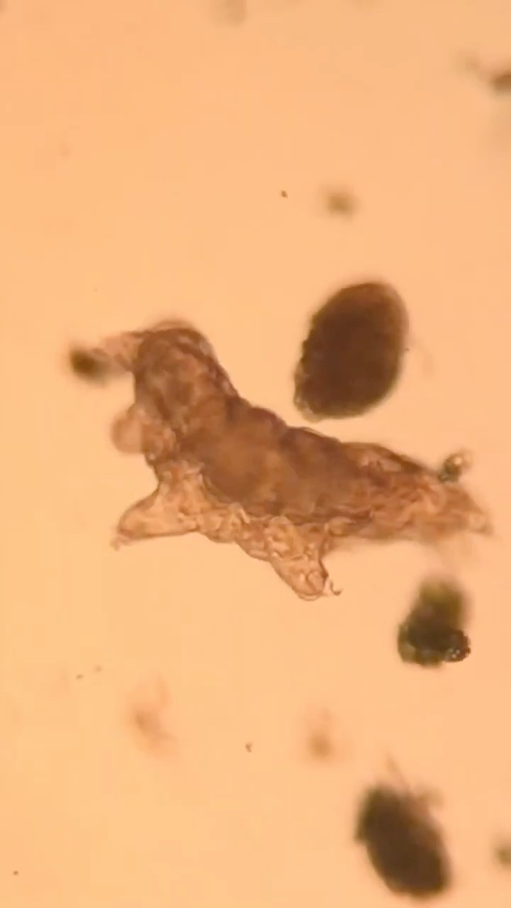 What's Special About This Microbe?