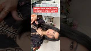 Hormonal or fungal acne?Follow for more and let me know your acne type#hormonproblemswithmadeeha#acn