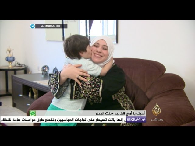 ساعة صباح.. ما هي "متلازمة داون" وكيف ندعم المصابين بها؟