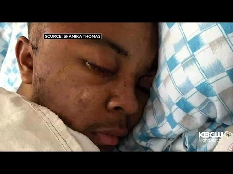 teen shot in the head Teen shot in the head