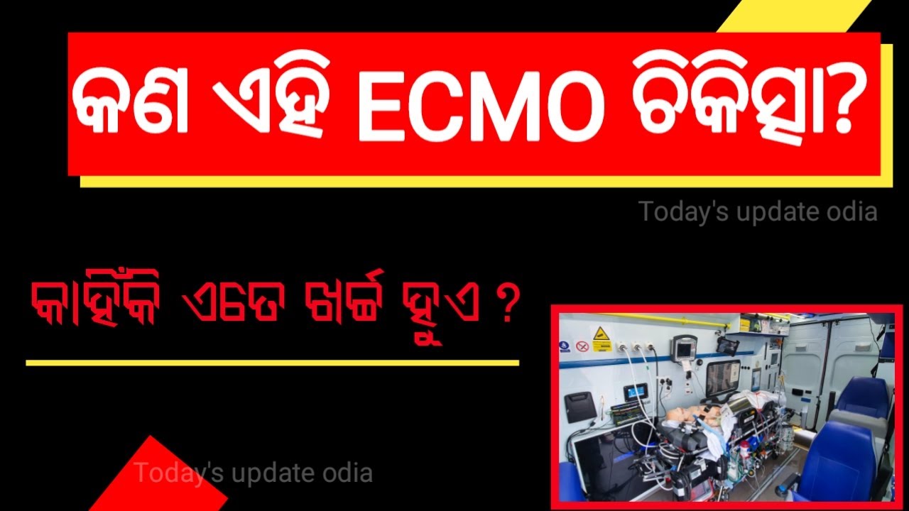 What is ECMO?//WHY ECMO is So Expensive?//TODAY'S UPDATE ODIA