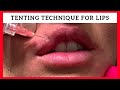 Tenting Technique for Lip Enhancement by Dr. Steven F Weiner