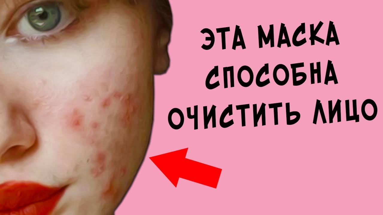 Сильнейшая маска! Маска из меда и лимона