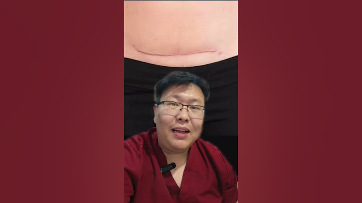 Sesar uda lama tapi luka masih sakit? Kenapa ya? #shorts
