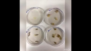 Physarum Polycephalum: An intelligent slime mold