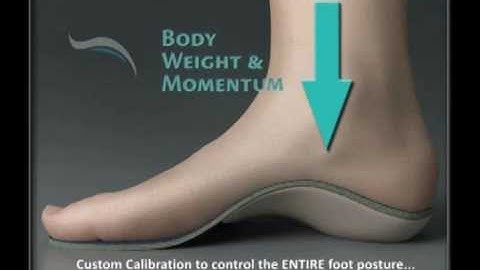 Why MASS Theory? Why MASS Theory Sole Support orthotics are better for your patients.