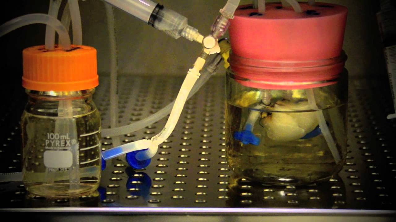 Bioreactor 