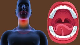 Swollen Uvula: Causes And Symptoms