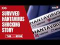 Survived Hantavirus: Shocking Story Behind the Deadly Infection Battle | Hantavirus News | N18G