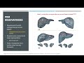 Miccai industrial talk deep implicit statistical shape models for 3d medical image delineation