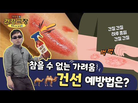 건선 치료법 3가지, 팩트체크🔍| 자이홍의 건강극장 ep.69