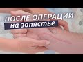 Реабилитация запястья. Что делать после операции на запястье?