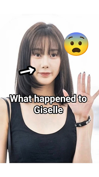 k-pop idols having justified plastic surgery allegations #shorts