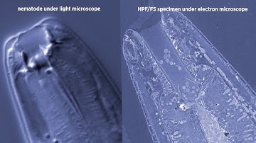 Using high pressure freezing to image microscopic worms