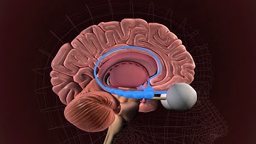 Inside the autism brain: Memory hub could underlie social, cognitive quirks of autism