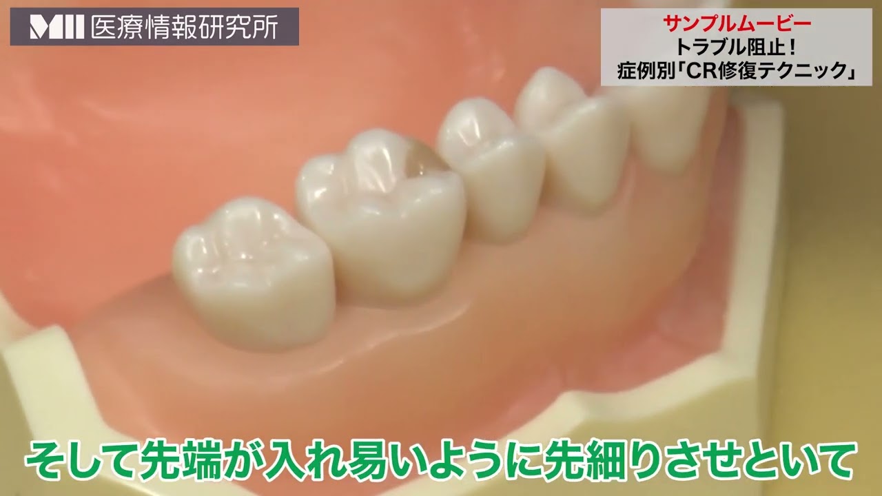 株式会社 医療情報研究所 | トラブル阻止！症例別「CR修復テクニック