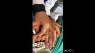 ممرضة لاول مرة في حقنة عضل