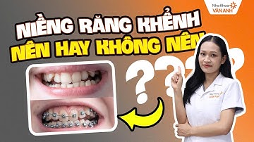 Khi Nào Nên Niềng Răng Khểnh? | Đừng Vội Vàng Niềng Răng Khểnh Nếu Chưa Xem Video Này!