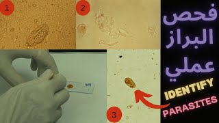 عملي تحليل البراز|Practical stool examination