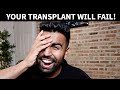 Why a Hair Transplant is NOT ENOUGH!