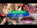 Lip care || Healthy &amp; soft lips Naturally ||weekly &amp; daily lip care | Dry chapped lips Bad breath 😷