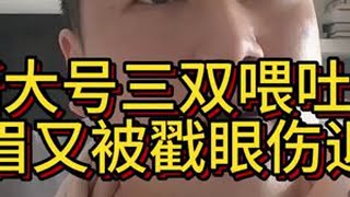#浓眉伤退#詹姆斯三双#湖人大胜猛龙#浓眉眼部受伤#湖人vs猛龙