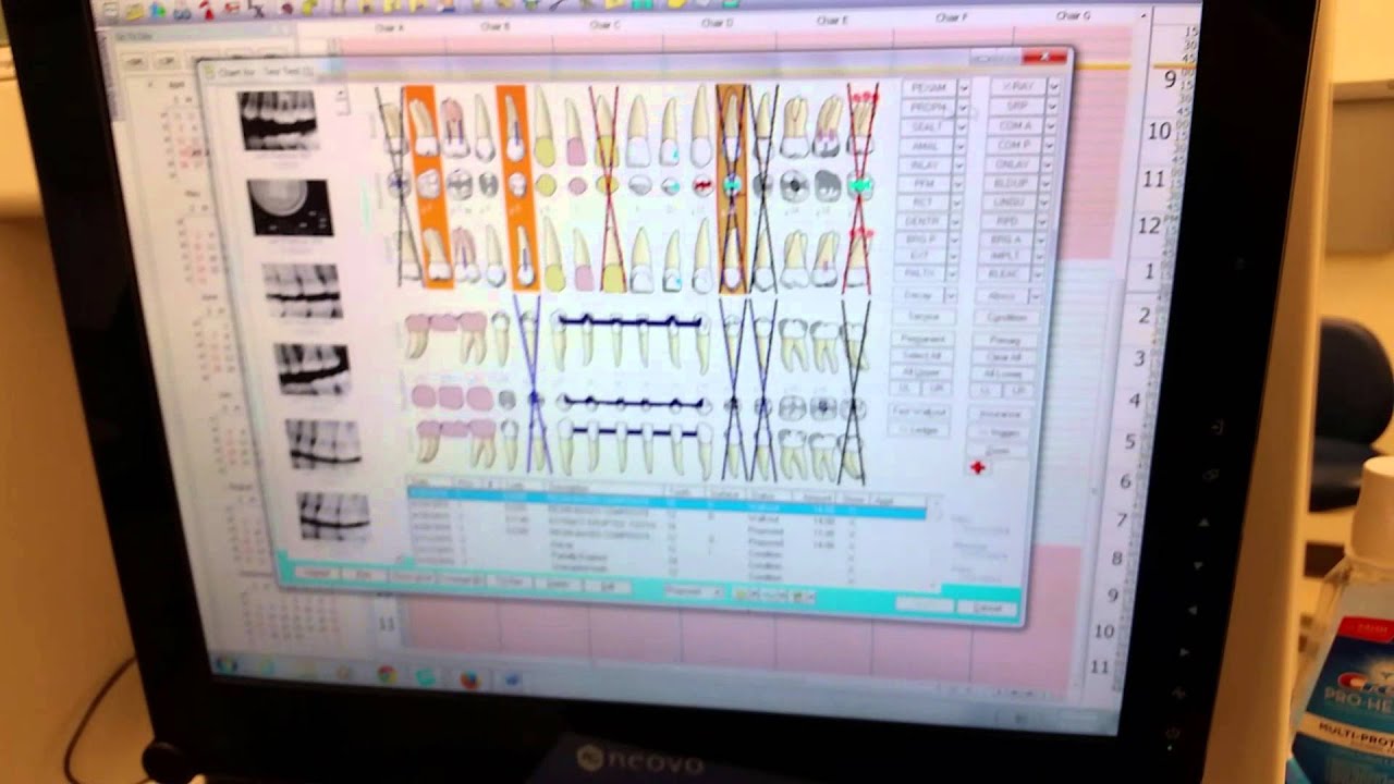 Eaglesoft Dental Charting