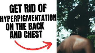 How To Get Rid Of Hyperpigmentation, Spots, Blemishes On The Chest And Back ✅(PHOTOS INSIDE)
