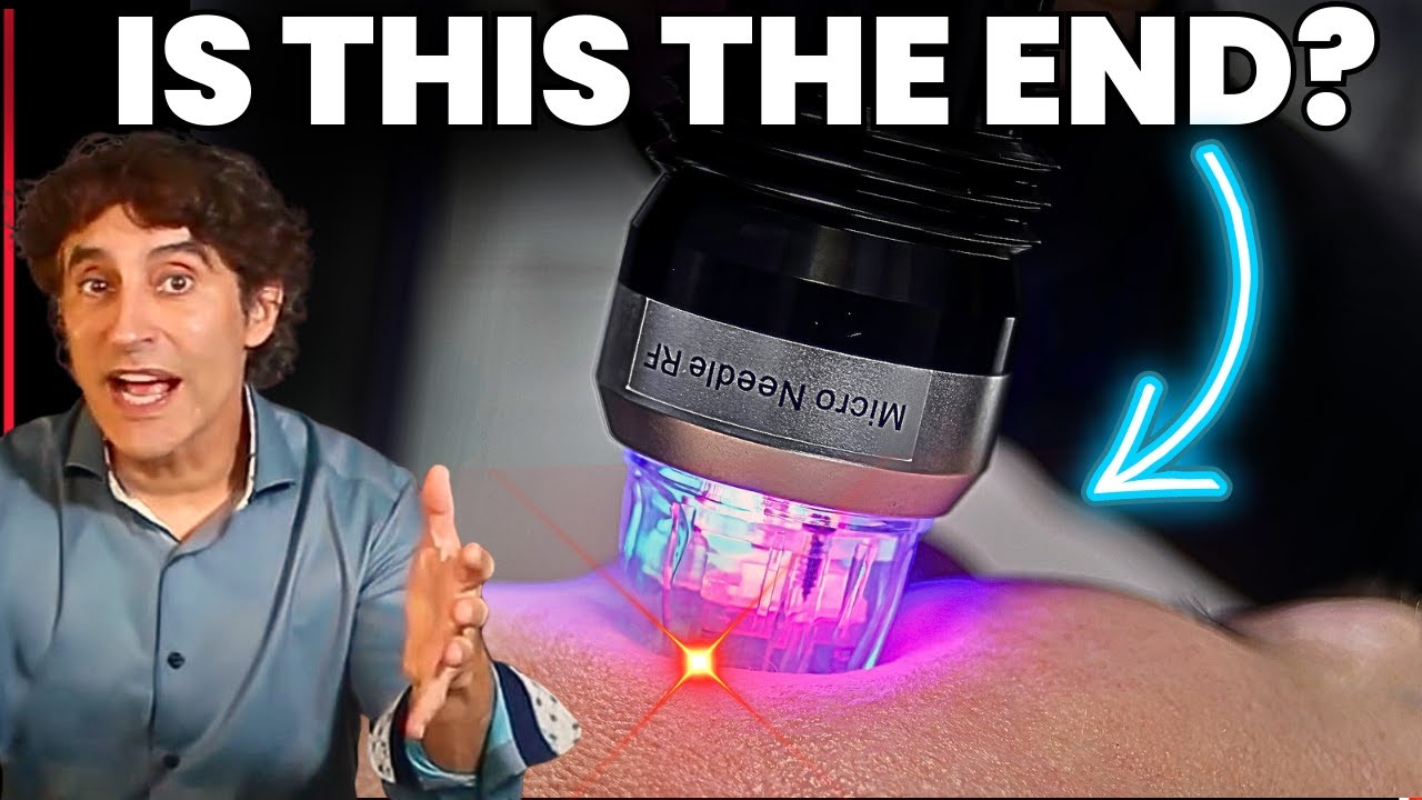 The Dark Side of MicroNeedling - Risks/ Results/ Regrets