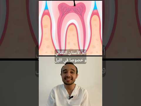 تلقائي و في الليل