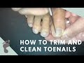 Foot Doctor Trims & Cleans Her Own Toenails