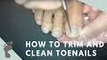 Video for Clean Toes and Foot Clinic