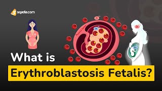 What is Erythroblastosis Fetalis? | Cell Biology | Medical Physiology
