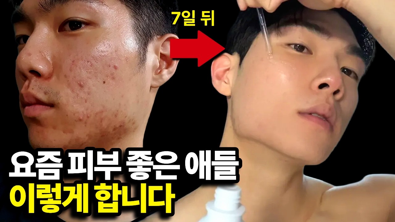 여드름쟁이들은 절대 모르는 내용입니다