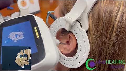 Digital 3D Ear Scanning with Otoscan