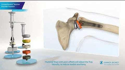 Comprehensive® Reverse Shoulder Humeral