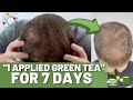 Green Tea For Hair Growth! 7 DAY RESULTS! Topical and Internal!