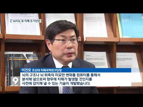 치매 미리 안다…‘한국인 뇌지도’ 개발