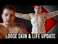 Being Open & Honest About my Life (Loose Skin & More)